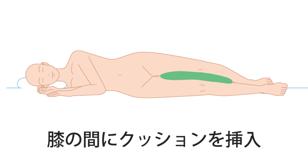 反り腰のため仰向けで寝られず横向きで寝る姿勢が続き、下になった肩に体重がかかることで巻き肩につながる流れを示した図