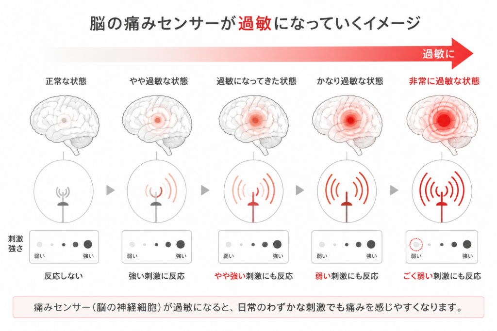痛み止めを飲み続けると脳が過敏になる仕組み|中枢感作のイメージ